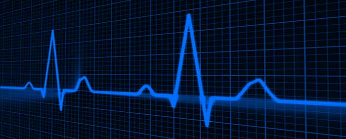 Livemonitoring Videoüberwachung